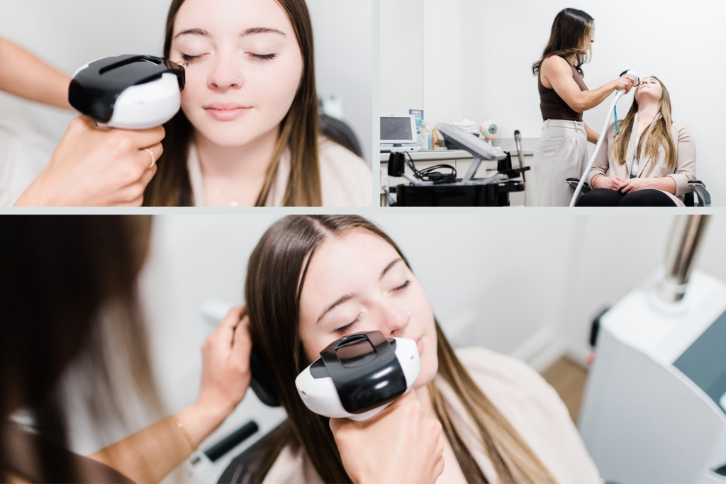 IPL dry eye treatment being performed on a patient at Nicola Eye Care in Kamloops using the InMode Lumecca handpiece.